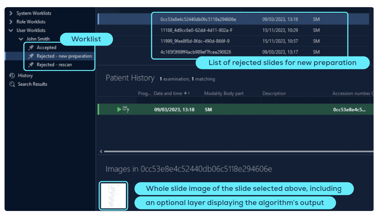 Screenshot of AiosynQC worklists on the Sectra platform showing different tabs with: a) whole-slide images (WSIs) that have passed the slide QC, b) WSIs flagged by AiosynQC due to the presence of artifacts that require new preparation, c) WSIs flagged by AiosynQC due to the presence of artifacts that require rescanning. At the bottom, it shows a preview of the selected digital slide, which can be clicked for further inspection.